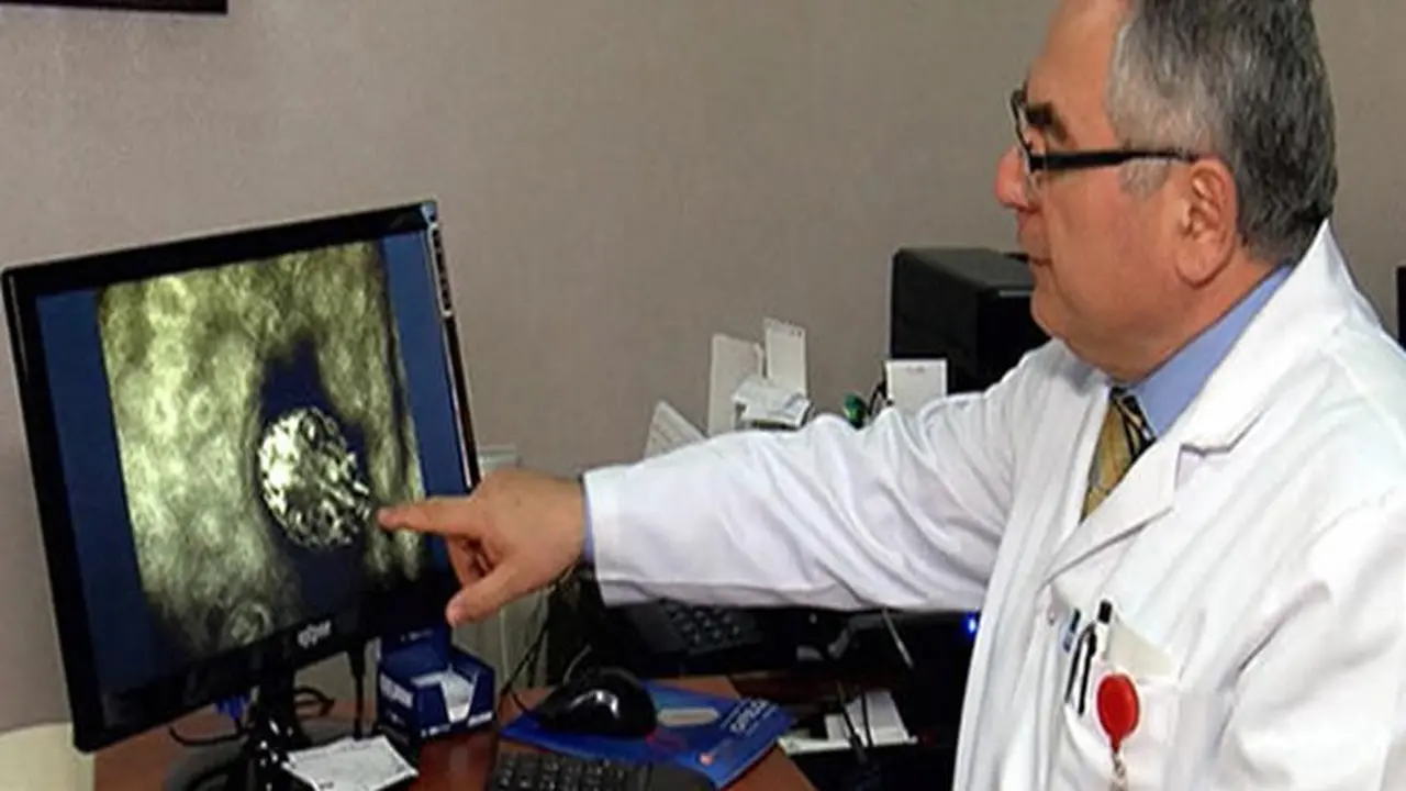 تصاعد حالات الجرب في بريطانيا: تأكيد 7 إصابات بين طلاب كلية ديفون وتحذيرات صحية عامة